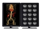Medical Displays –  – K9602855