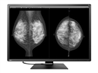 Medical Displays –  – RX1270-BK