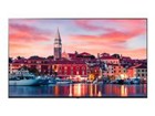 Hotel & Hospitality TVs & Displays –  – 75UR762H