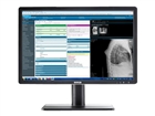 Medical Displays –  – K9307944B