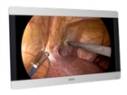 Medical Displays –  – K9352051