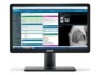 Computer Monitors –  – K9610941B
