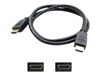 एचडीएमआई केबल्स –  – HDMI2HDMI15F-5PK